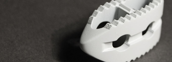 Transforaminal Lumbar Interbody Fusion (TLIF) Spine Implant|3C Spine